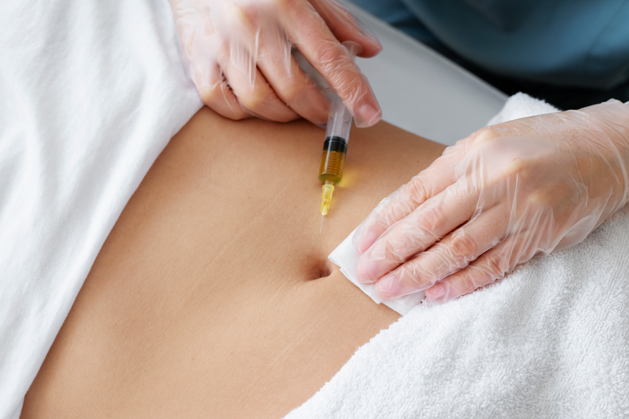 Intradermoterapia
